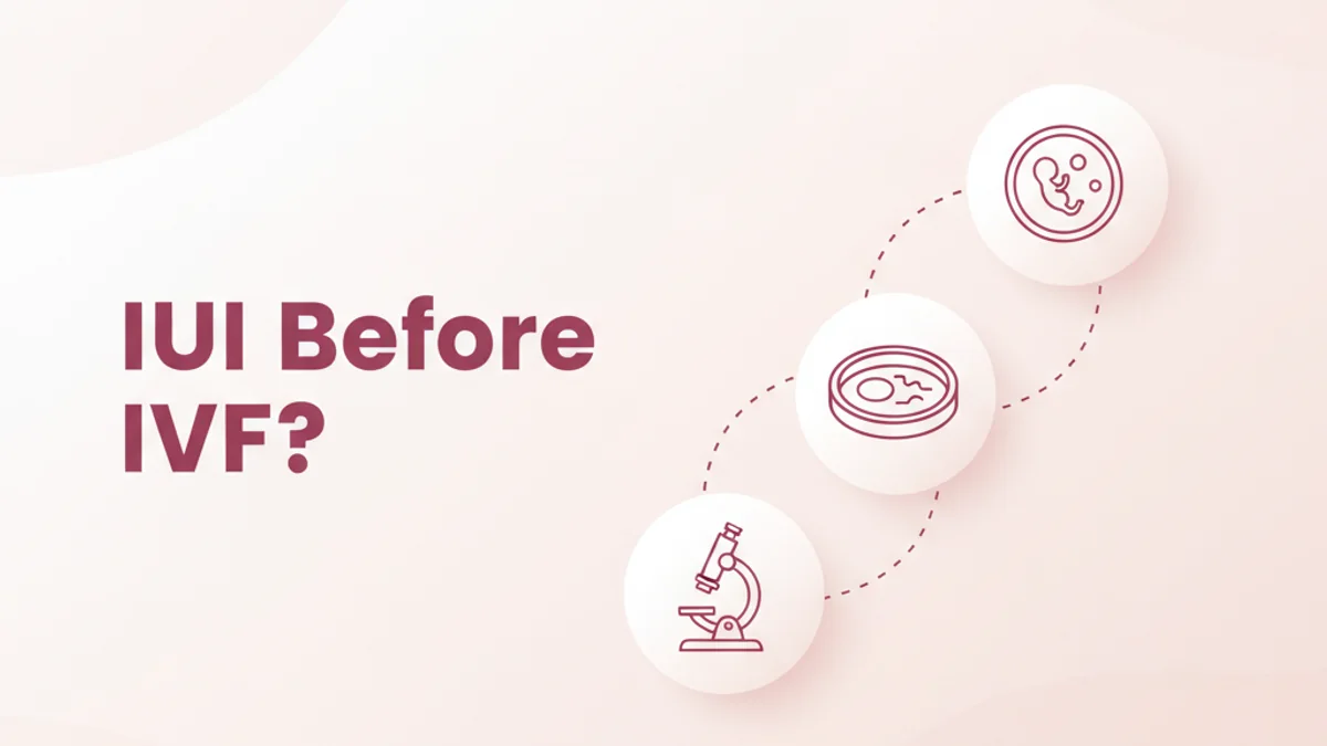 How Many IUI Cycles Before IVF?
